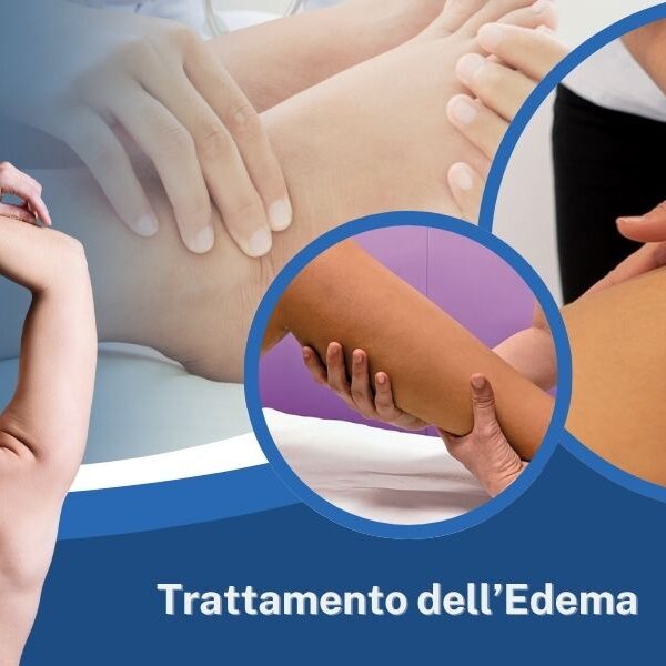 Massofisioterapista per il trattamento dell’edema linfatico ad Ancona da Paladini Simona Massofisioterapista